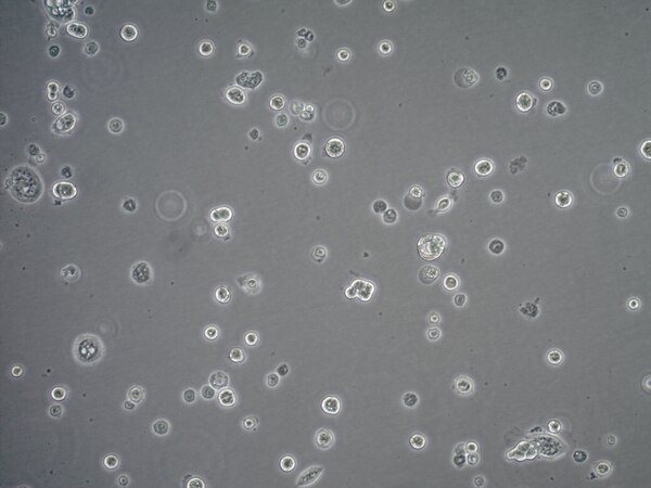 Calu-3 Human Lung Adenocarcinoma Cell Line 